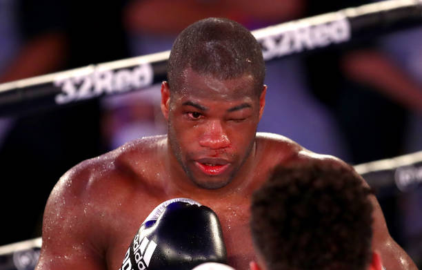 Daniel Dubois furing his fight with Oleksandr Usyk