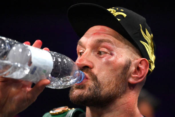 Tyson Fury sporting a swollen eye after the bout